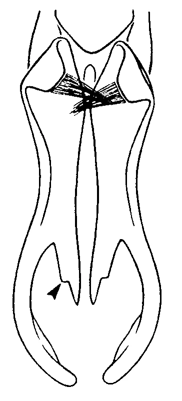 couplet drawing