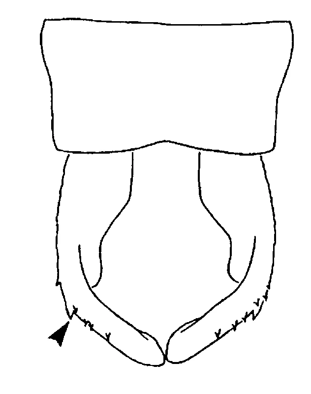 couplet drawing