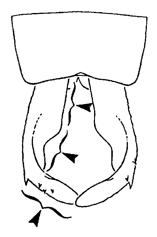 couplet drawing