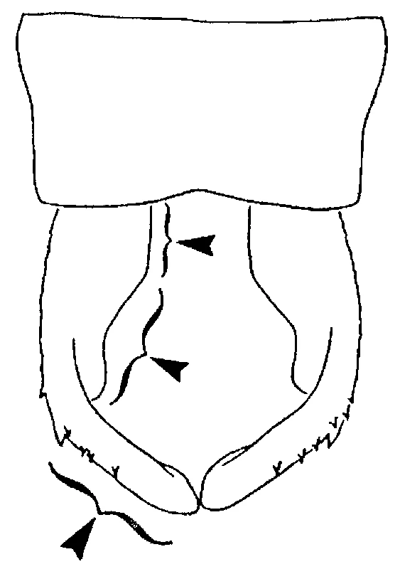 couplet drawing
