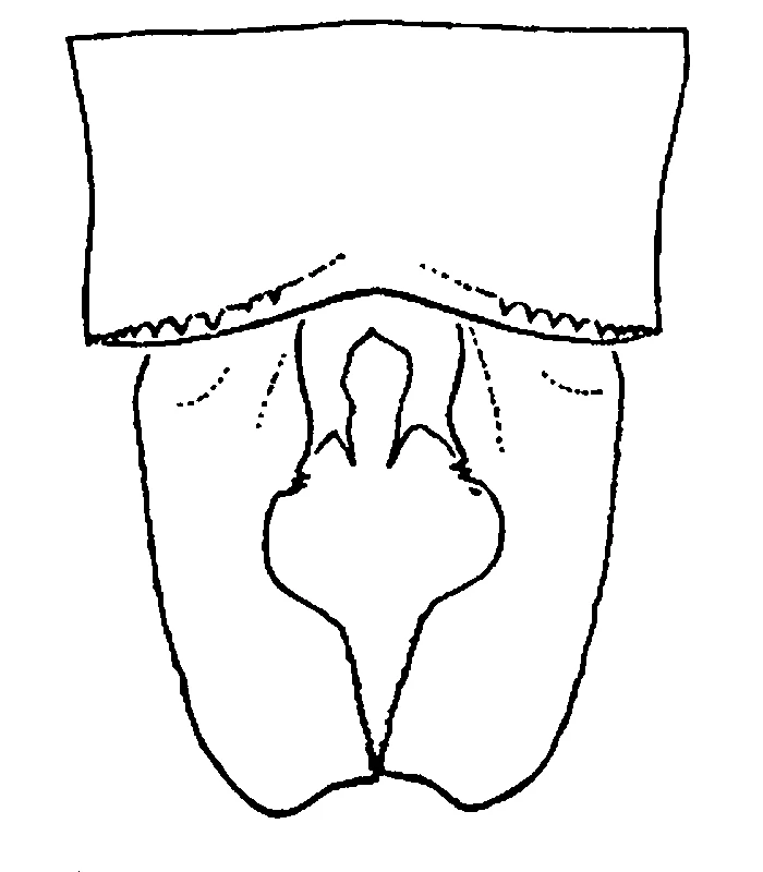 couplet drawing