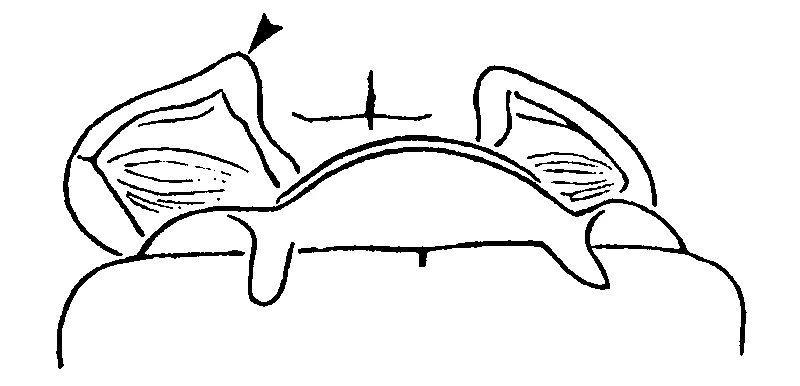 couplet drawing