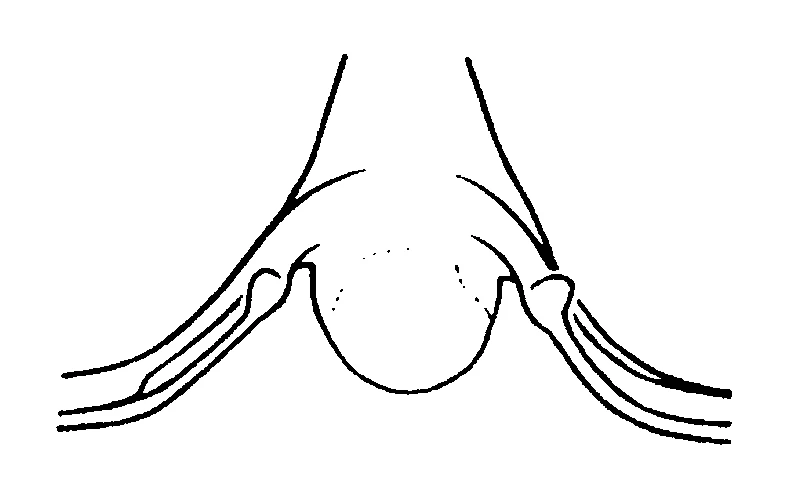 couplet drawing