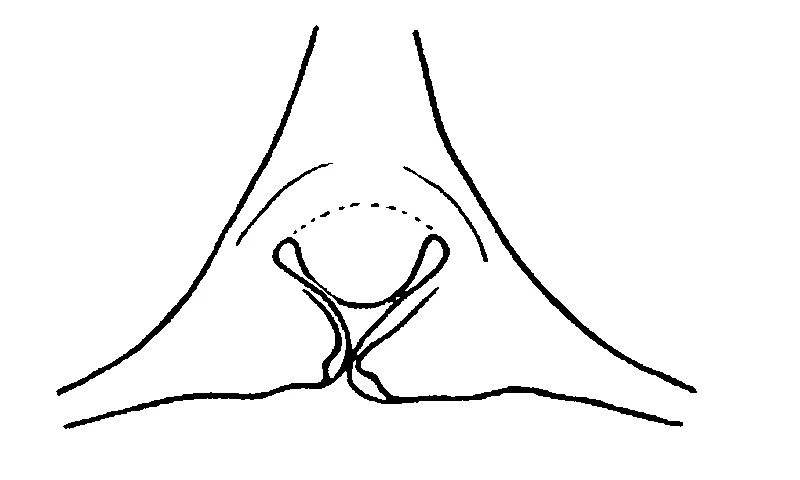 couplet drawing