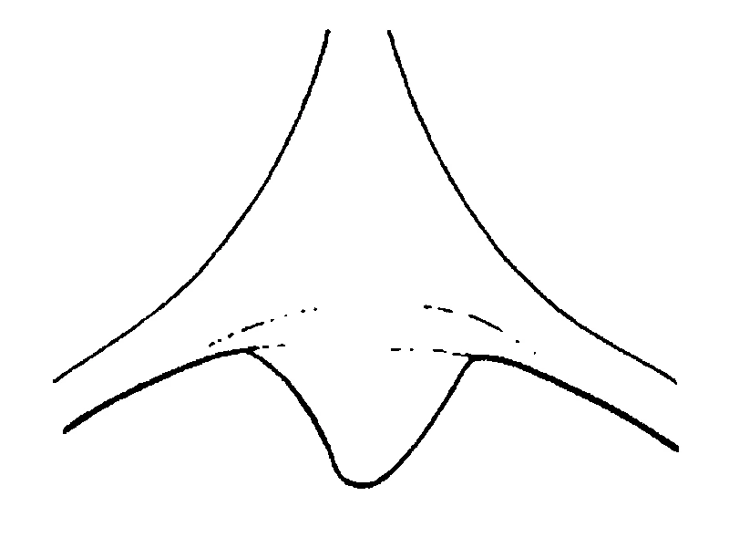 couplet drawing