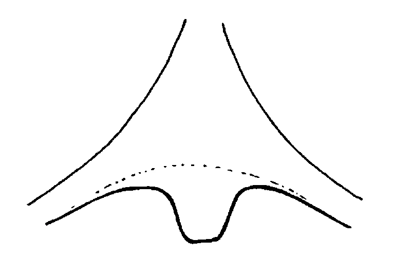 couplet drawing