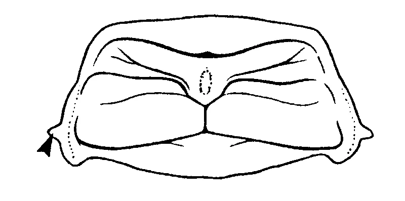 couplet drawing