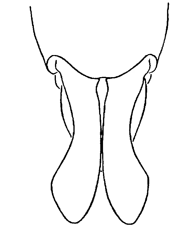 couplet drawing